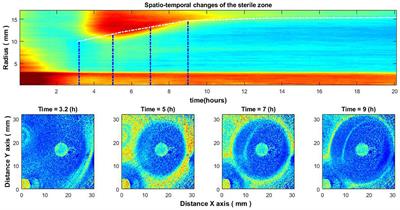 Corrigendum: Laser speckle imaging for visualization of hidden effects for early detection of antibacterial susceptibility in disc diffusion tests